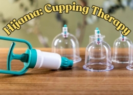 Hijama in Islam