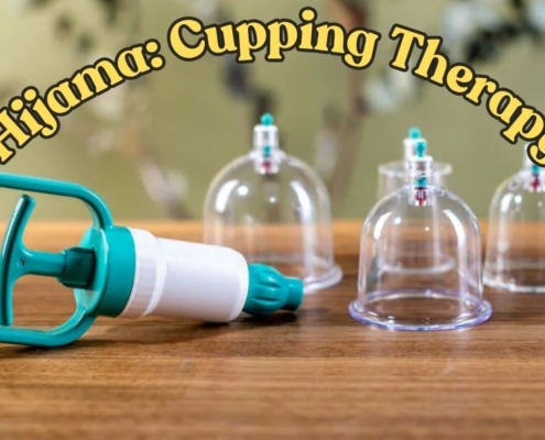 Hijama in Islam