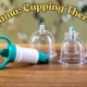 Hijama in Islam