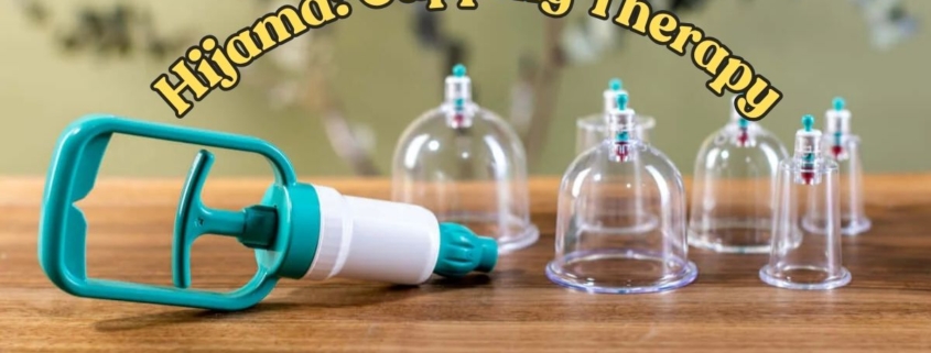 Hijama in Islam