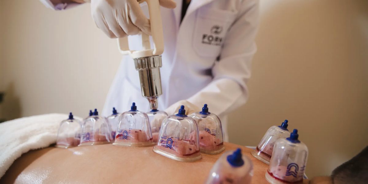 Hijama in Islam